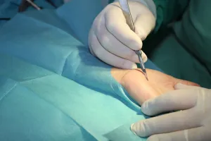 Wrist Arthroscopy